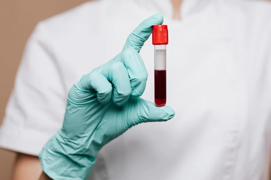 Estudo investiga possível relação entre transfusão de sangue e Alzheimer, mas não há prova de transmissão